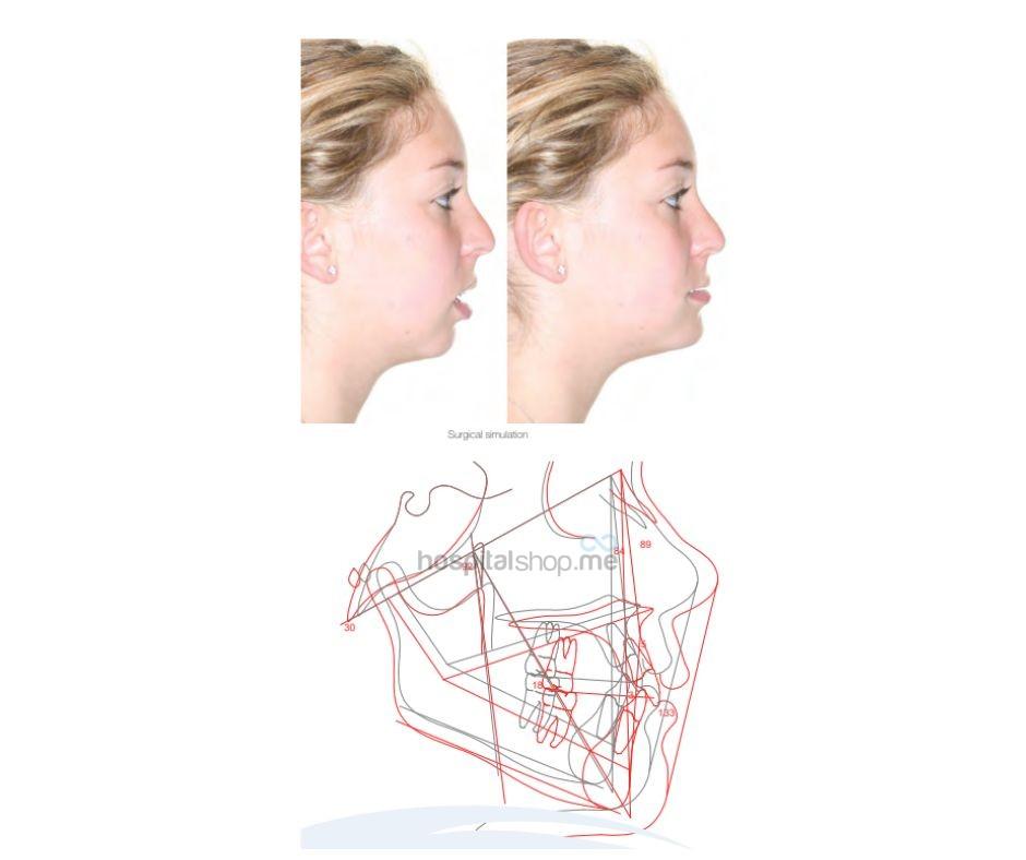 Dolphin Treatment Simulation Dental Software