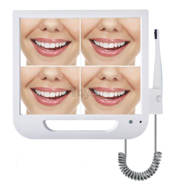 Trusta Intraoral Camera - Video Output + Monitor